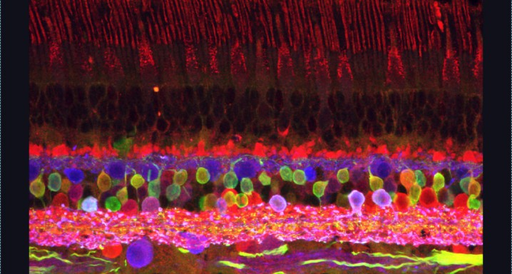 40MPU-CR-GLY-SYN_Snapshot_01 para RESULTADOS ALFA-SYN 1