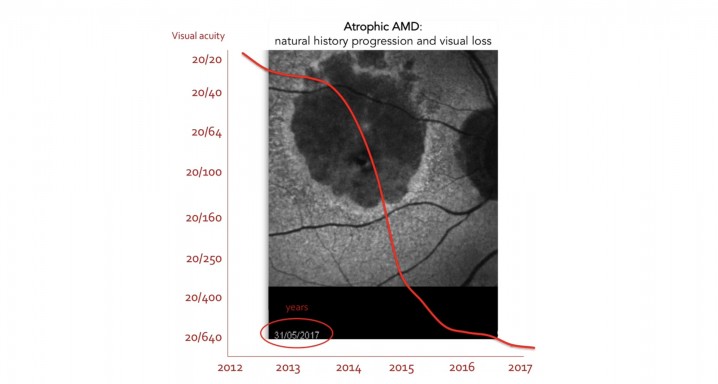 amd3